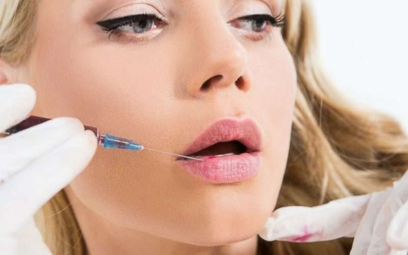 The Rise of Lip Filler Treatments