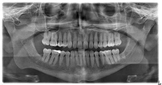 Instant X-Ray: Instant X-Ray: