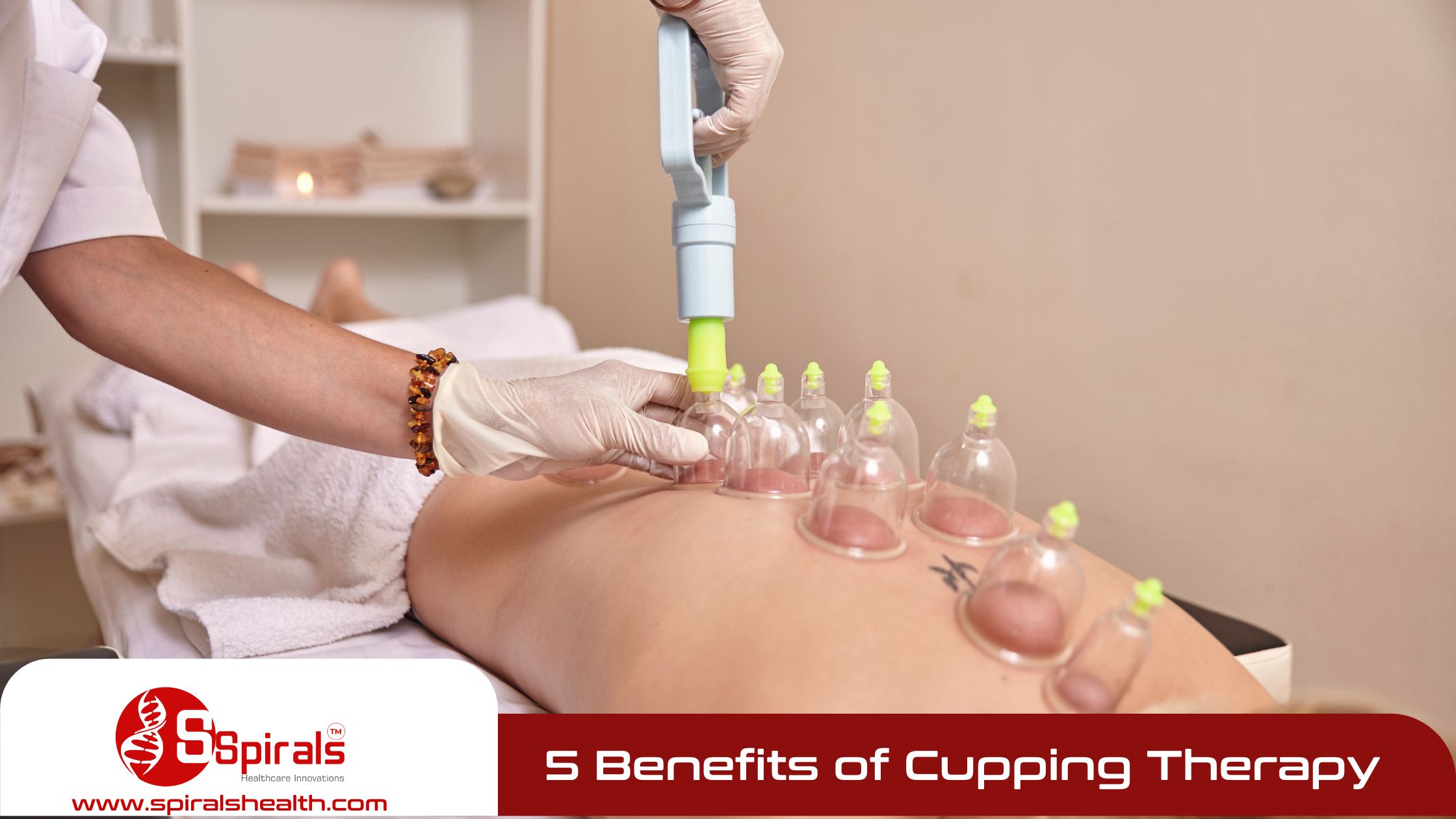 5 Benefits of Cupping Therapy