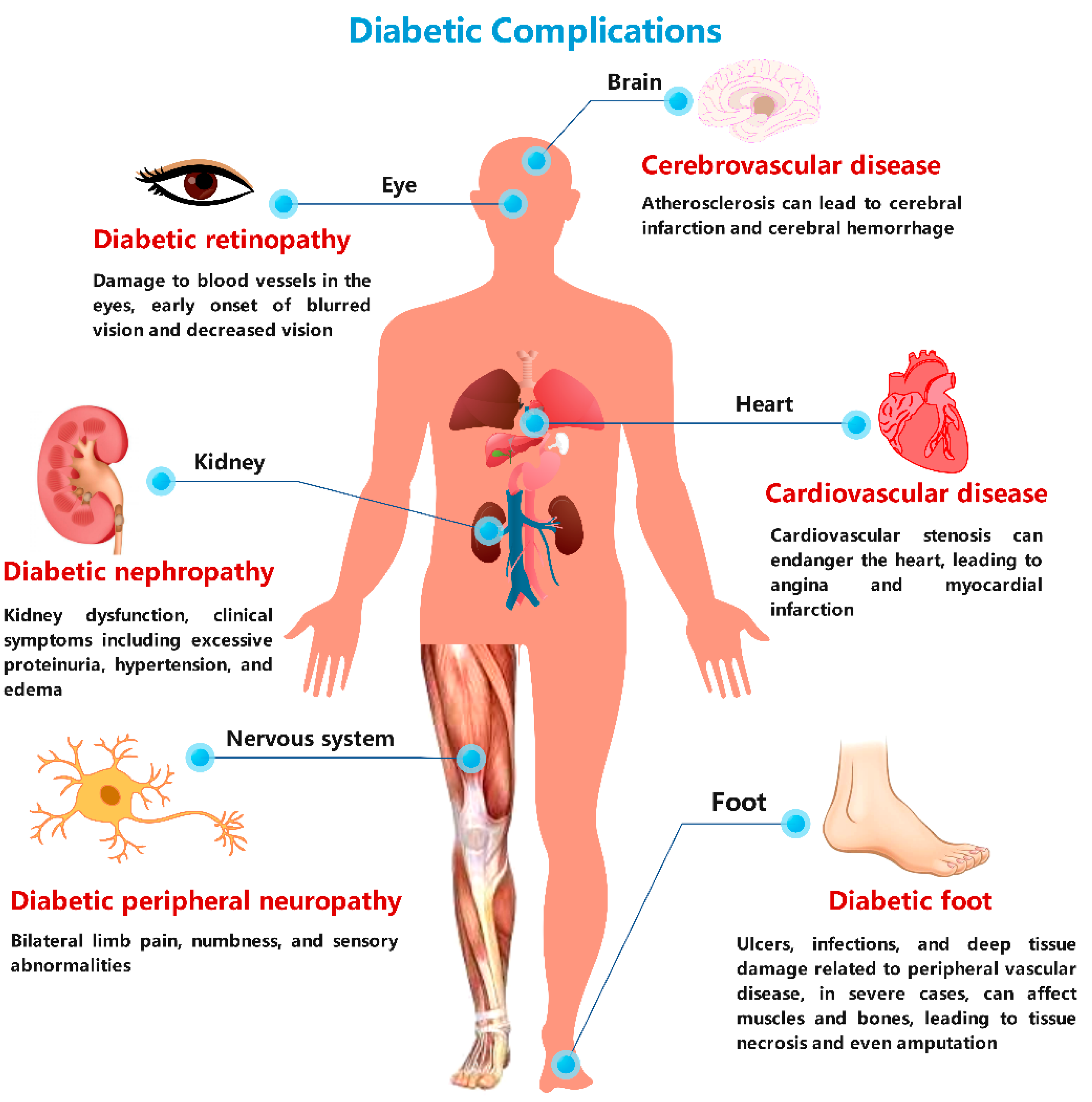 DIABETES and its management