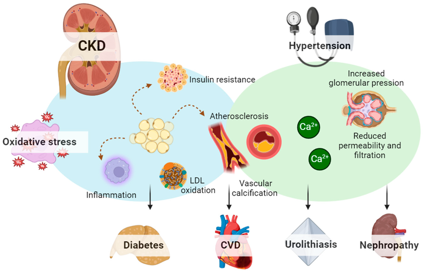 CKD and its complications
