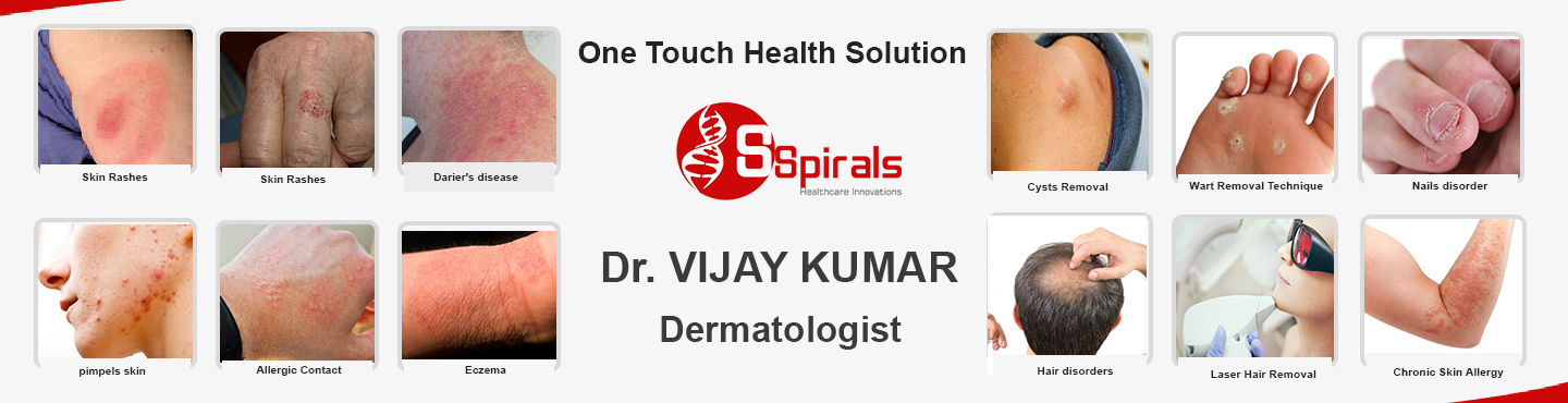 1565952580_Dr-Vijay-Kumar_Dermatologist-in-Greater-Kailash_New-Delhi.jpg